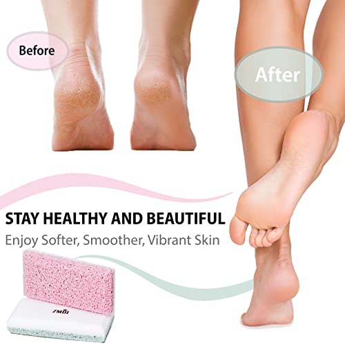 Siliglass Pumice Stone Callus Remover - Dual-Sided Exfoliator for Feet, Hands, Elbows & Knees