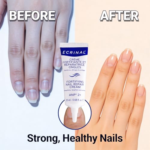 Ecrinal ANP2+ Fortifying Nail Repair Cream, 20ml - Strengthens & Grows