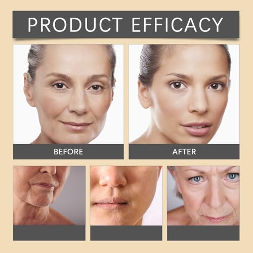 MULPG 3-Pack Bee Venom Wrinkle Removal Cream - Firming, Hydrating 20g