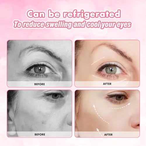 Viigunence Reusable Silicone Under Eye Patches with Metal Applicator – Minimize Fine Lines & Wrinkles