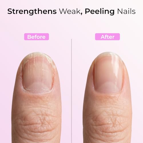 ORLY Nail Rescue Kit for Cracked & Broken Nails - Brush-On Glue, Repair Powder, Buffer
