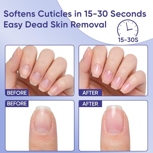 SASSYTIP Cuticle Remover Gel & Strengthening Nail Oil Pen Bundle