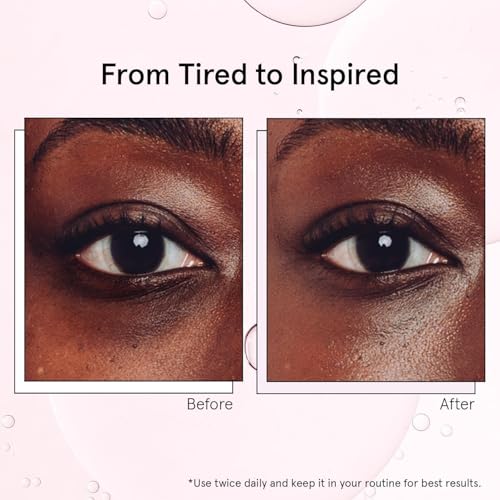 Grace & Stella Cooling Eye Serum Roller with Metal Ball 15ml – Caffeine, Niacinamide