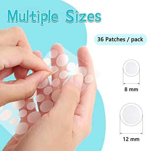 180 Hydrocolloid Acne Patches for Fast Pimple Treatment