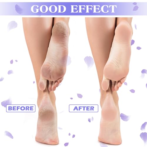 Tarpop Aloe Socks Women Moisturizing Gel Sleep Socks Floral Purple 3 Pairs