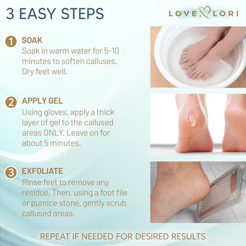 Callus Remover for Feet (Extra Strength) Foot Callus Remover Gel - Pedicure Tools for Feet Scrubber ? Foot Care Spa Essentials, 6oz