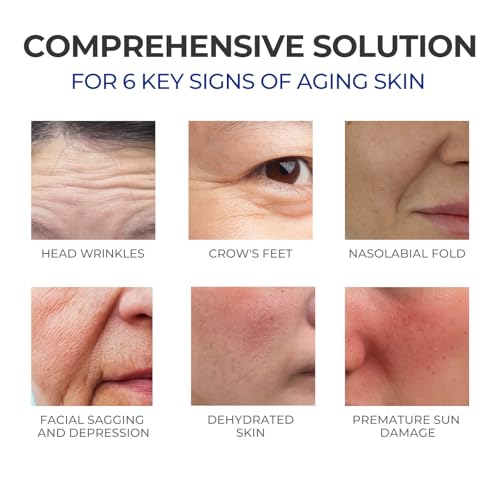 SKINERSE 0.3% Retinol Serum for Face – Anti-Aging Collagen Facial Treatment