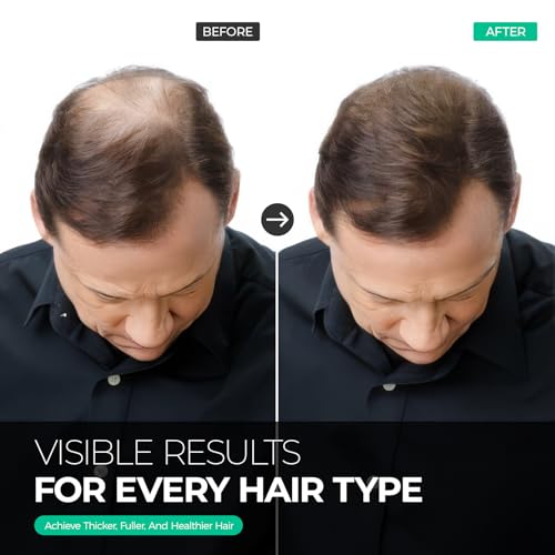 Hair Growth Shampoo & Conditioner Set for Thinning Hair