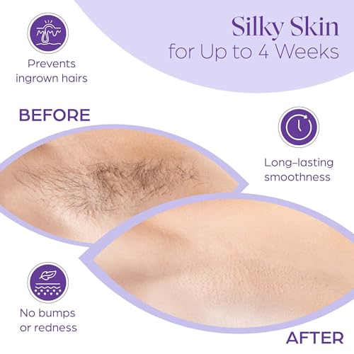 765 Professional Wax Strips for Waxing ? Tear-Resistant Fabric Hair Removal Strips ? 225 Large & 540 Small ? Reusable for Warm Wax & Sugar Paste ? Face, Body & Intimate Areas