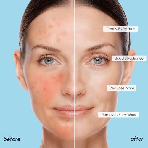 MAREE Glycolic Acid Pads - Toner Pads for Face Cleansing - Exfoliating Pad with Tea Tree Oil, Salicylic Acid & Vitamins E, B3, B5 - Facial Polishes & Peels, Skin Pore Resurfacing & Radiance - 50 Count