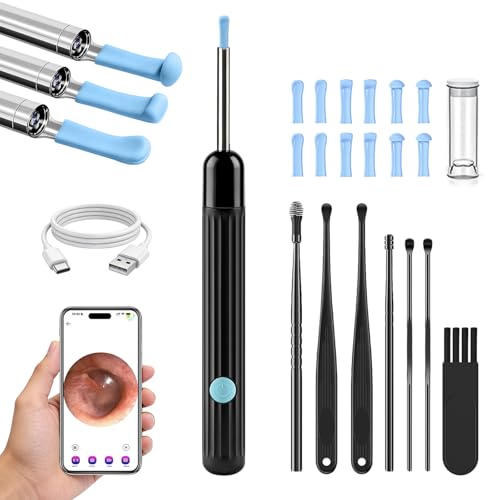AudScope Black 1080P HD Ear Camera & Wax Removal Kit with LED Lights for Adults & Kids