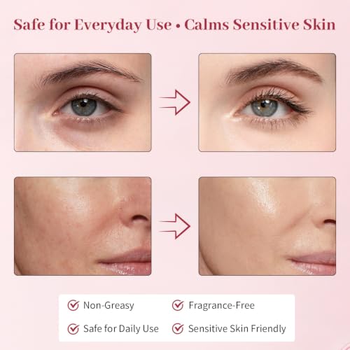 Sylvaseren PDRN Pink Volume Balm Stick - Anti-Aging, Wrinkle, Firming & Glow Treatment for Face, Eyes, Neck 10g