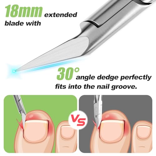 HANDWENG Ingrown Toenail Clippers for Thick Nails, Ultra Sharp Wide Jaw