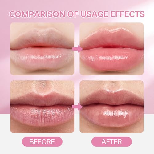 Emgmcp 5% PHA Exfoliating Lip Serum - Hydrating Overnight Lip Treatment