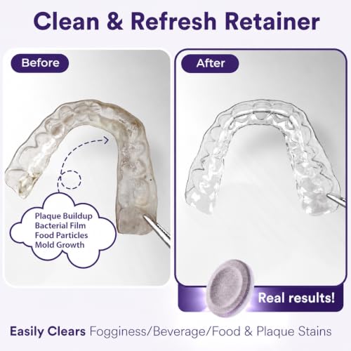 B. Weiss Weiss Naturals Retainer Cleaner Tablets 30 Count Grape Scent, Persulfate-Free