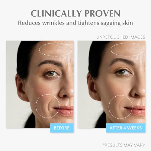 EnaSkin Retinol Collagen Face Cream with 7% Hyaluronic Acid - Anti-Aging Moisturizer for Neck & Décolleté, 1.7 Oz