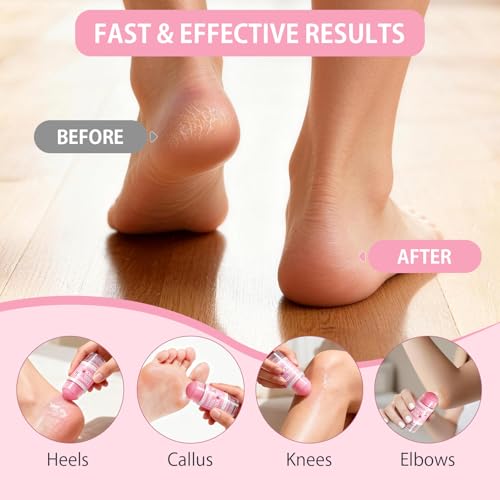 Aluroice Pink Silicone Moisturizing Socks with 60% Urea Foot Cream Set - Dry Heel Care