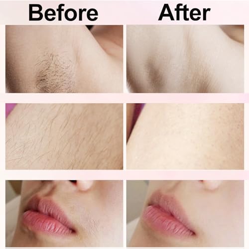 Nursetek 2-in-1 Electric Shaver for Women - Pink, Rechargeable Razor for Legs, Face & Bikini