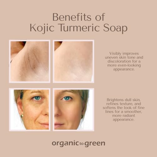 Organic To Green Kojic Turmeric Body Soap for Dark Spots - 3 Pack with Hyaluronic Acid, Retinol, Vitamin E, Shea Butter, Collagen, Lemon, Ginger & Lavender
