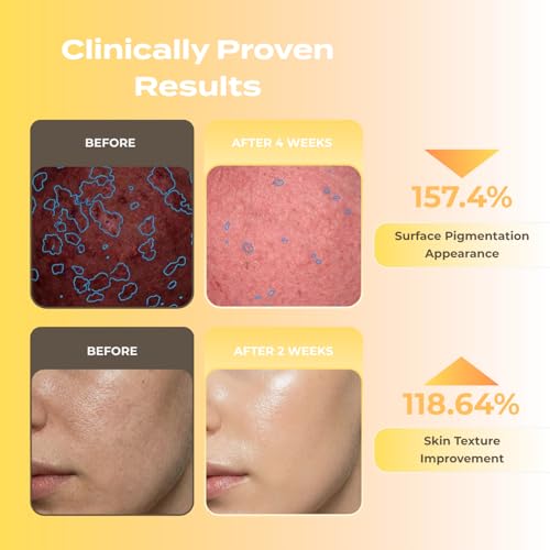Microneedling Serum with Salmon DNA & Collagen for Korean Glass Skin - 1.1 FL OZ