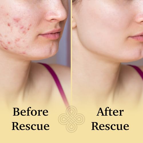 Hypochlorous Acid Face Spray for Sensitive Skin - Soothing Skin Relief Mist