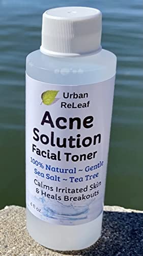 Urban ReLeaf Acne Solution Facial Toner, 4 Fl Oz - Soothe Breakouts & Reduce Pores