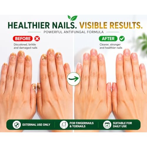 Nail Treatment, Tratamiento Para U?as, Extra Strength Nail Renewal, Made in USA