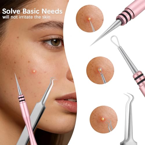Pink Professional Facial Milia Blackhead Remover Tool Kit with Titanium Needle & Tweezers