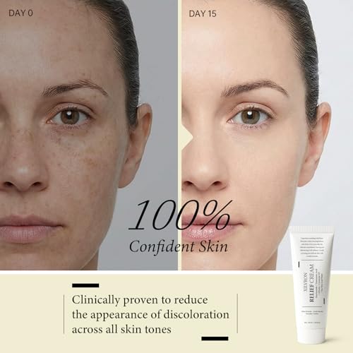 XILRVON Barrier Relief Cream with Niacinamide & Arbutin 1.69 Fl Oz - Sensitive Skin Support