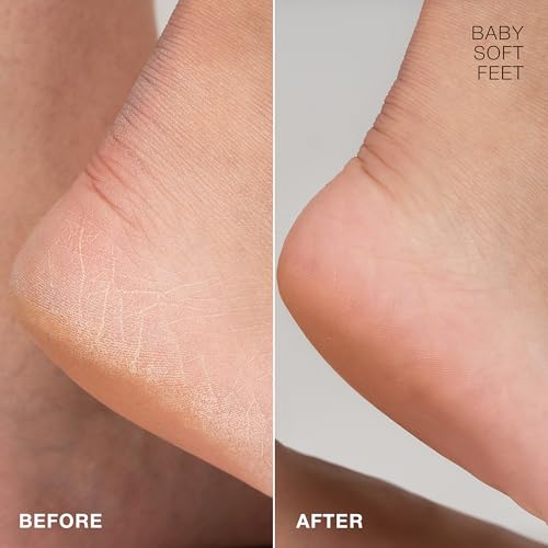 STARSKIN Magic Hour Exfoliating Foot Mask, K-Beauty Callus Remover