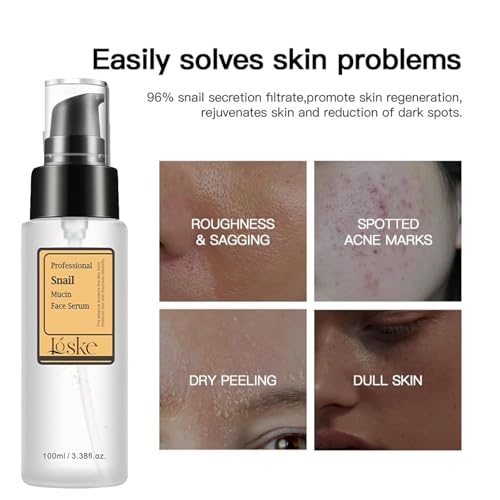 Loske Snail Mucin Serum - Hydrating & Repairing Essence for All Skin Types