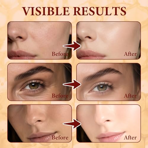 Kallteren Bee Venom Skin Cream - Anti-Aging Moisturizer for Face & Body