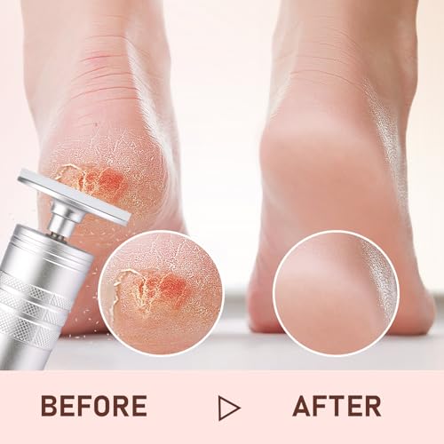 Kredioo Electric Foot Callus Remover - Silver 5 in 1 Nano Glass Pedicure Tool