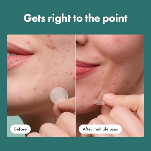 Mighty Patch Micropoint Acne Pimple Patches - 8 Ct with Salicylic Acid