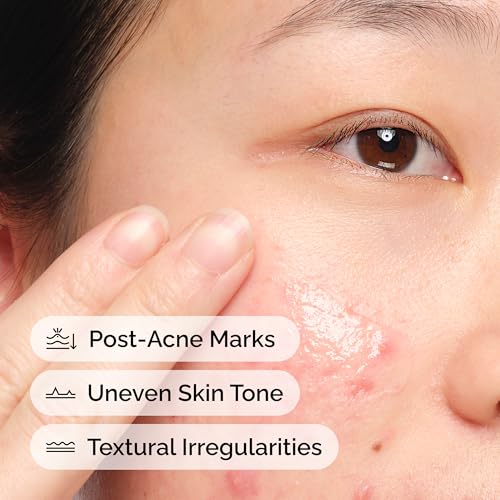 The Ordinary Aloe 2% + NAG 2% Solution for Post-Acne Marks