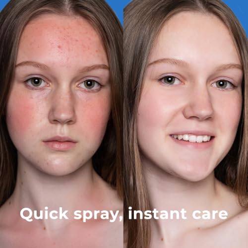 PatchRx Hypochlorous Acid Facial Spray - 8 oz Hydrating Mist for Sensitive Skin