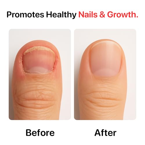 C CARE Nail Biting Prevention for Kids & Adults - Bitter Deterrent 0.5 fl oz