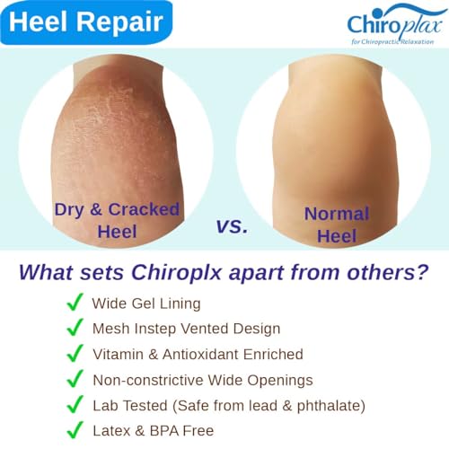 Chiroplax Black Vented Moisturizing Gel Heel Socks (2 Pairs) Spa-Quality Overnight Foot Care