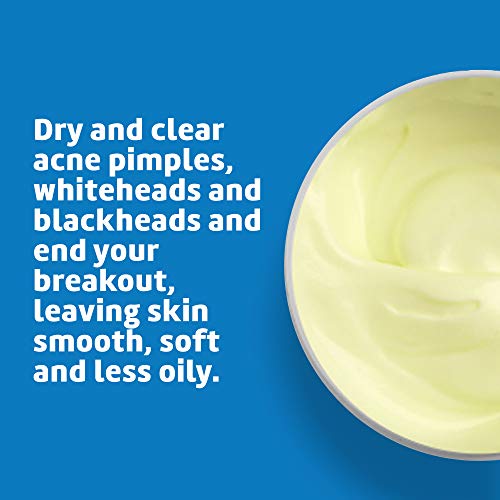 De La Cruz 5% Sulfur Acne Treatment Ointment for Sensitive Skin - 0.42 oz