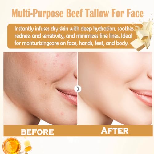 Organic Grass-Fed Beef Tallow Balm with Raw Honey & Citrus – 2 OZ Skin Moisturizer