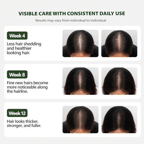 8K8 Hair Growth Serum Roll-On for Thinning Hair with Biotin & Rosemary
