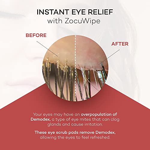 Zocular Zocuwipe Eyelid Wipes with Natural Okra Complex ? Gentle Eyelid Cleansing & Moisturizing Pads ? 40 Count