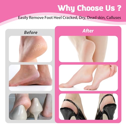 Electric Foot Callus Remover - Speed Adjustable Pedicure Tool in Pink