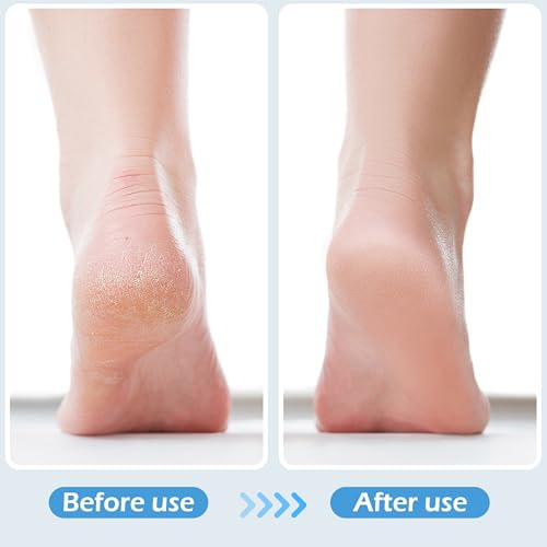 4-in-1 Foot Brush and Callus Remover Set - 2 Black Gray Foot Scrubbers by TaShow