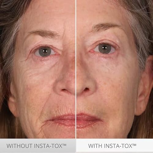 Serious Skincare INSTA-TOX Instant Wrinkle Smoothing Serum - Temporary Face Tightener, Facial Filler for Deep Wrinkles, Fine Lines, Pores - Sodium Hyaluronate + Retinyl Palmitate - 0.75 Oz (2 Pack)