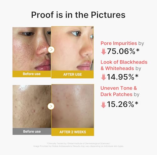 Medicube Peel Shot with Kojic Acid - Exfoliating Face Treatment for Glow