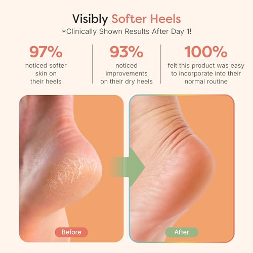 ZenToes Moisturizing Socks for Cracked Heel Treatment, Vitamin E, Olive Oil and Jojoba Oil Infused Heel Socks, Spa Gifts for Women, Relaxation Gifts for Women (Fuzzy Pink, Regular)