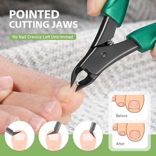 Baluca Straight Toenail Clippers for Thick & Ingrown Nails – Green