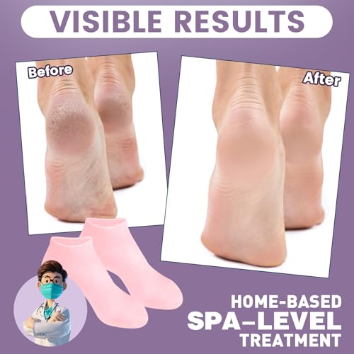 TEAWOO Moisturizing Silicone Heel Socks for Cracked Feet - 2 Pairs