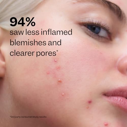 Peach Slices Acne Clarifying Cleanser - 2% Salicylic Acid, Vegan